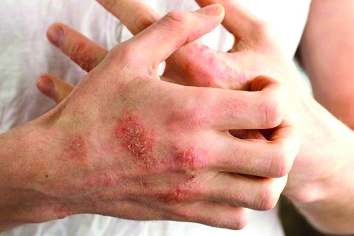 Cilt hastalıklarının altında yatan gizli tehlike